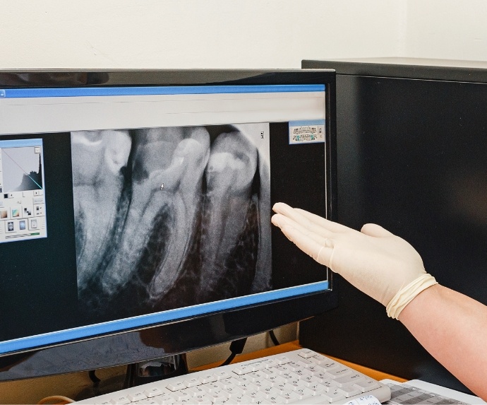 Digital x ray images on a computer monitor